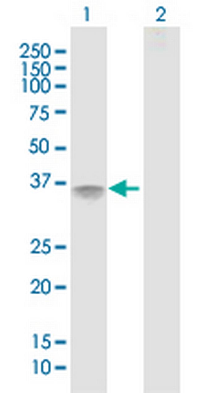 IL2RA Antibody in Western Blot (WB)