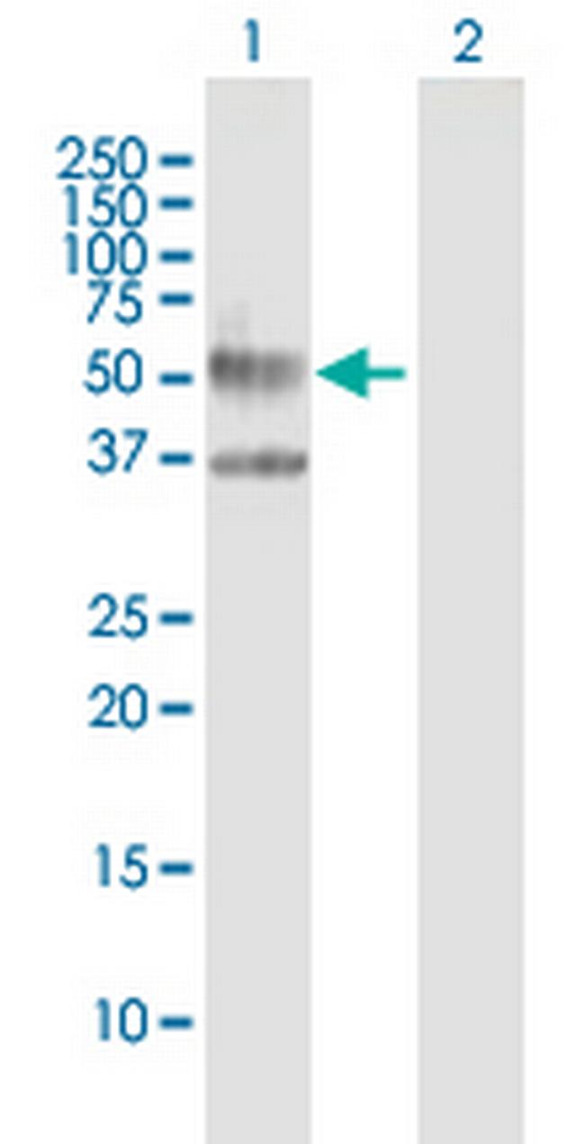IL3RA Antibody in Western Blot (WB)