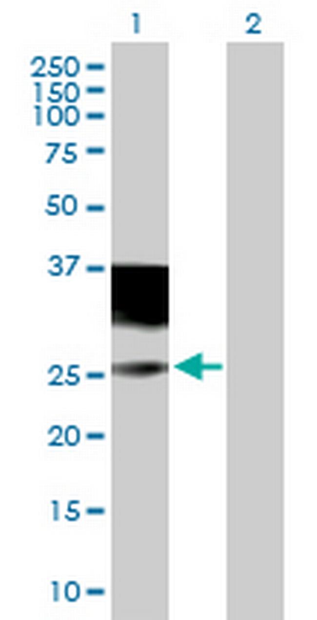 IL4R Antibody in Western Blot (WB)