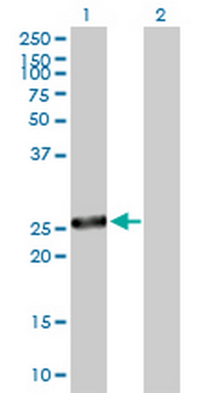 IL6 Antibody in Western Blot (WB)