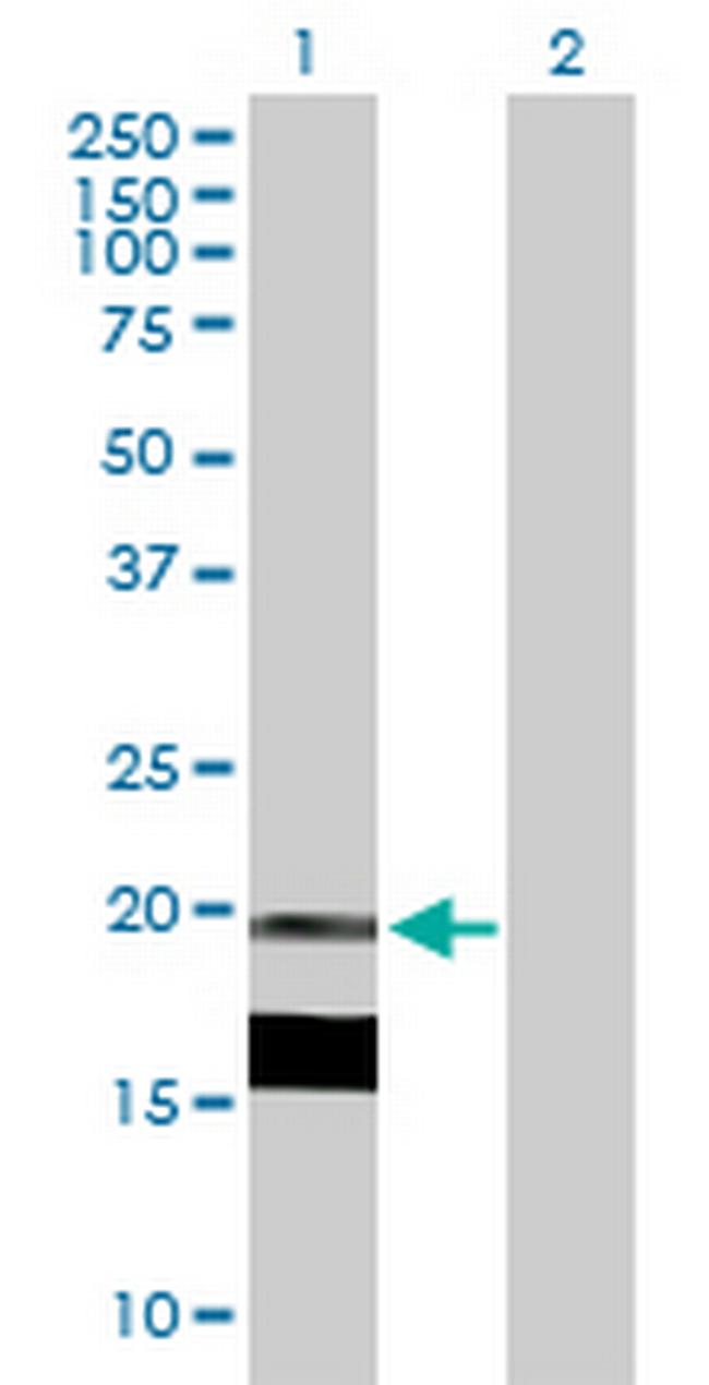 IL7 Antibody in Western Blot (WB)