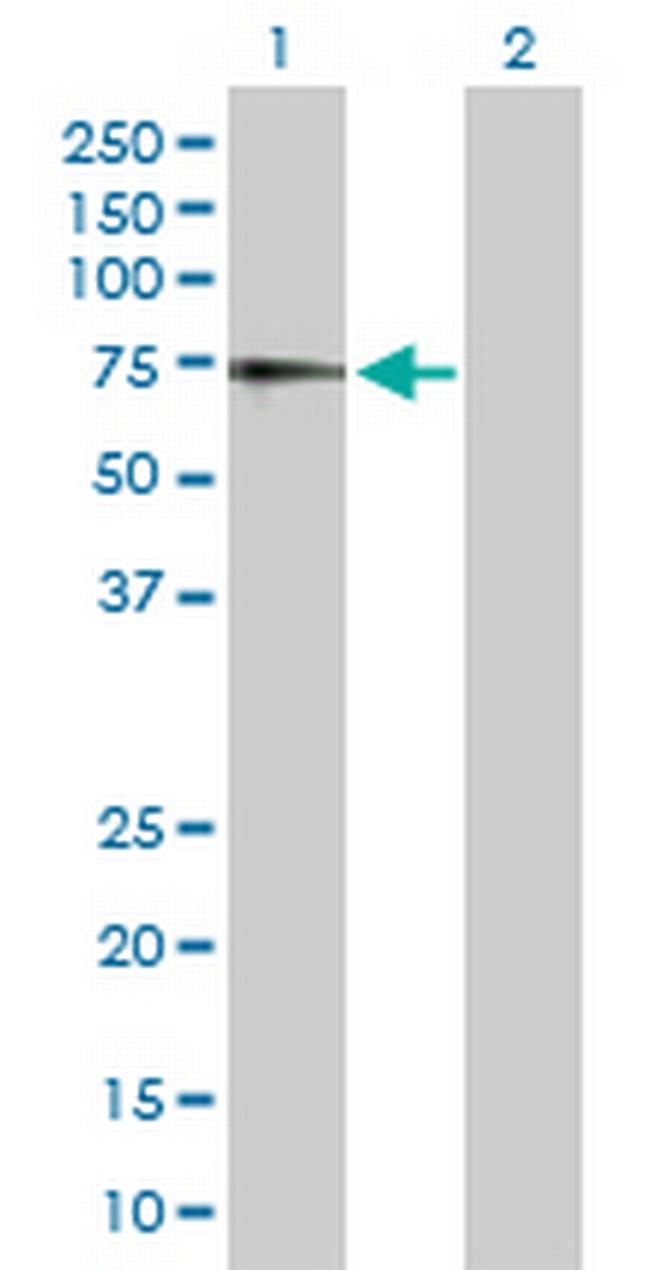 IL7R Antibody in Western Blot (WB)