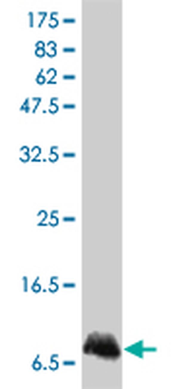 IL8 Antibody in Western Blot (WB)