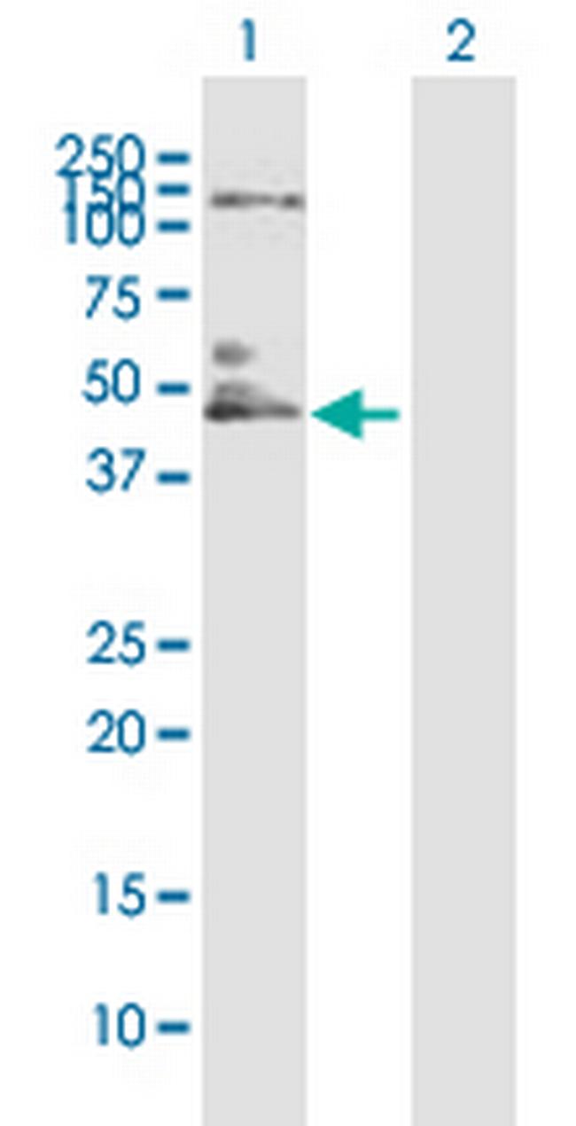 IL10RB Antibody in Western Blot (WB)