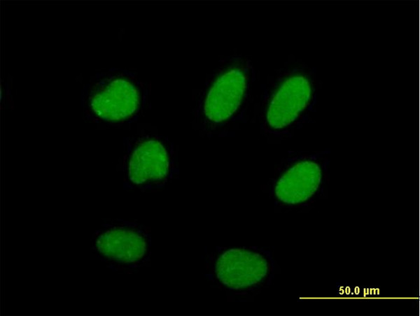 ILF2 Antibody in Immunocytochemistry (ICC/IF)