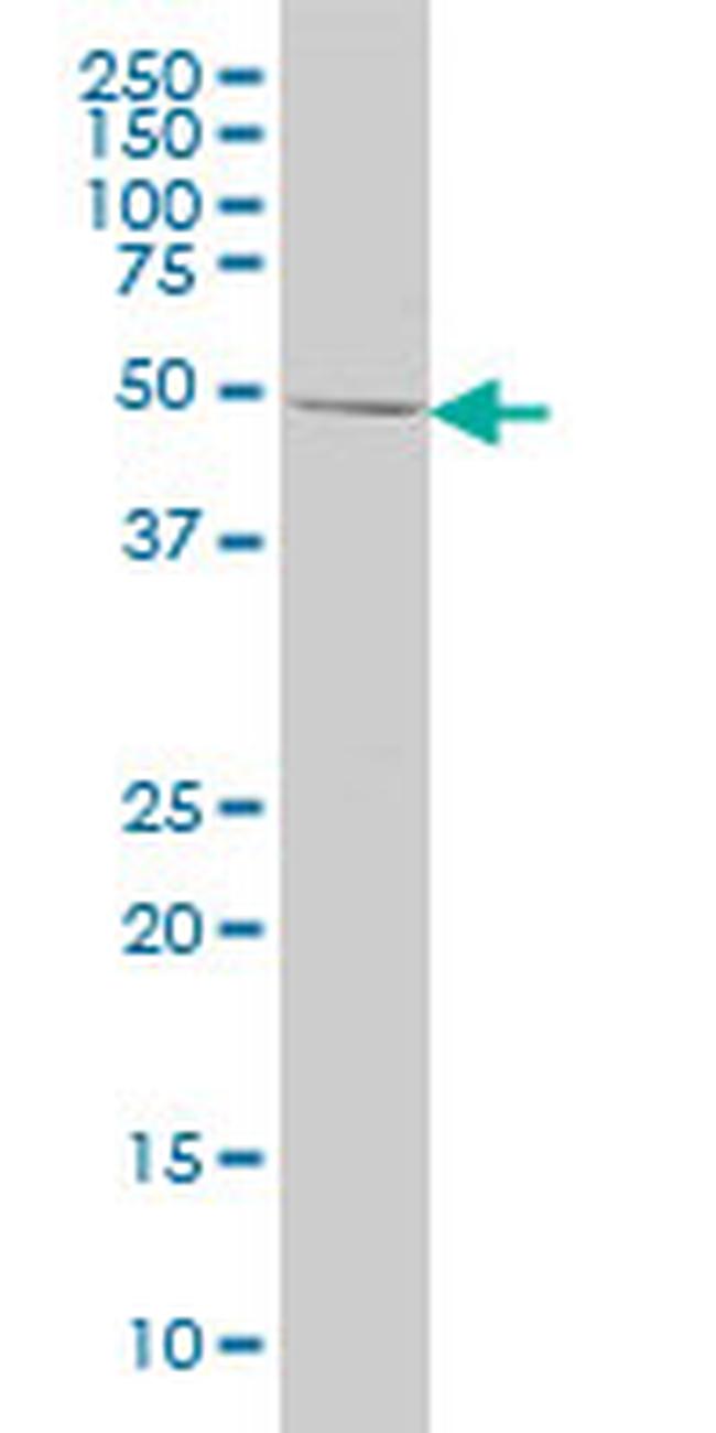 ING1 Antibody in Western Blot (WB)