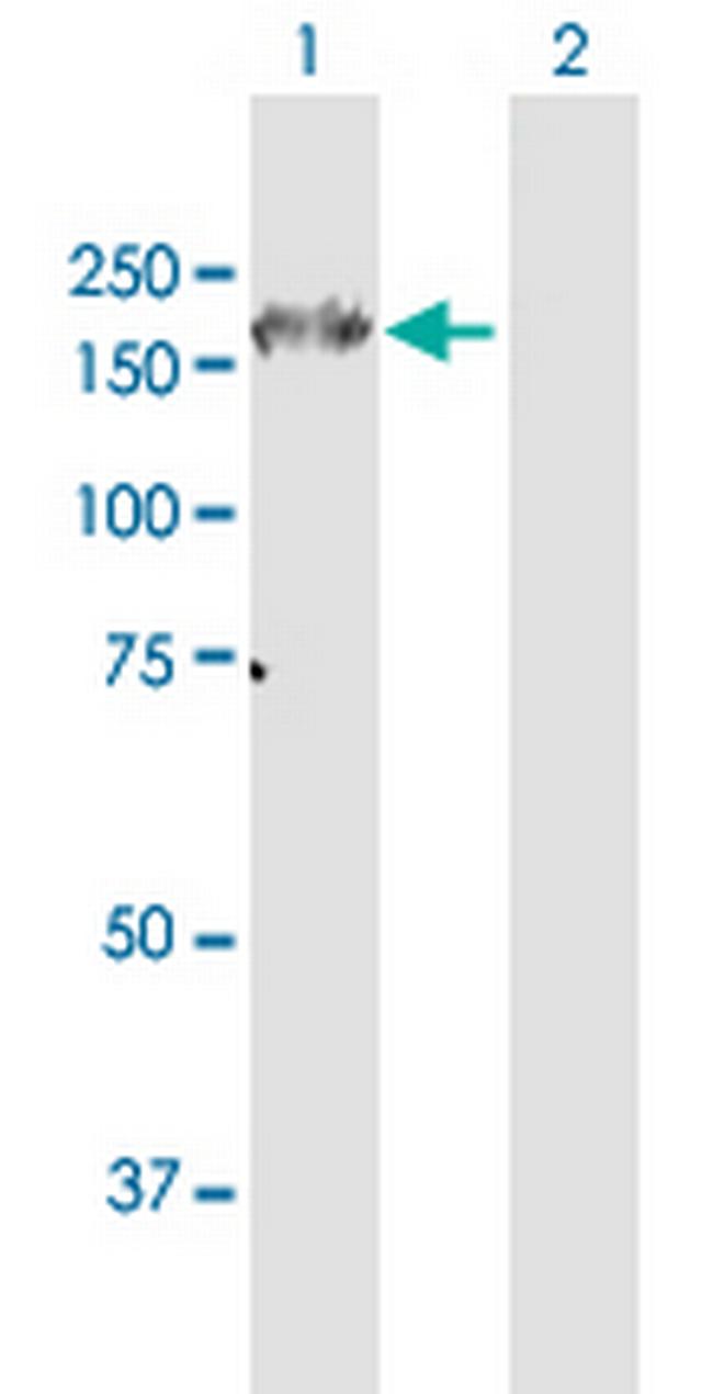 ITGA6 Antibody in Western Blot (WB)