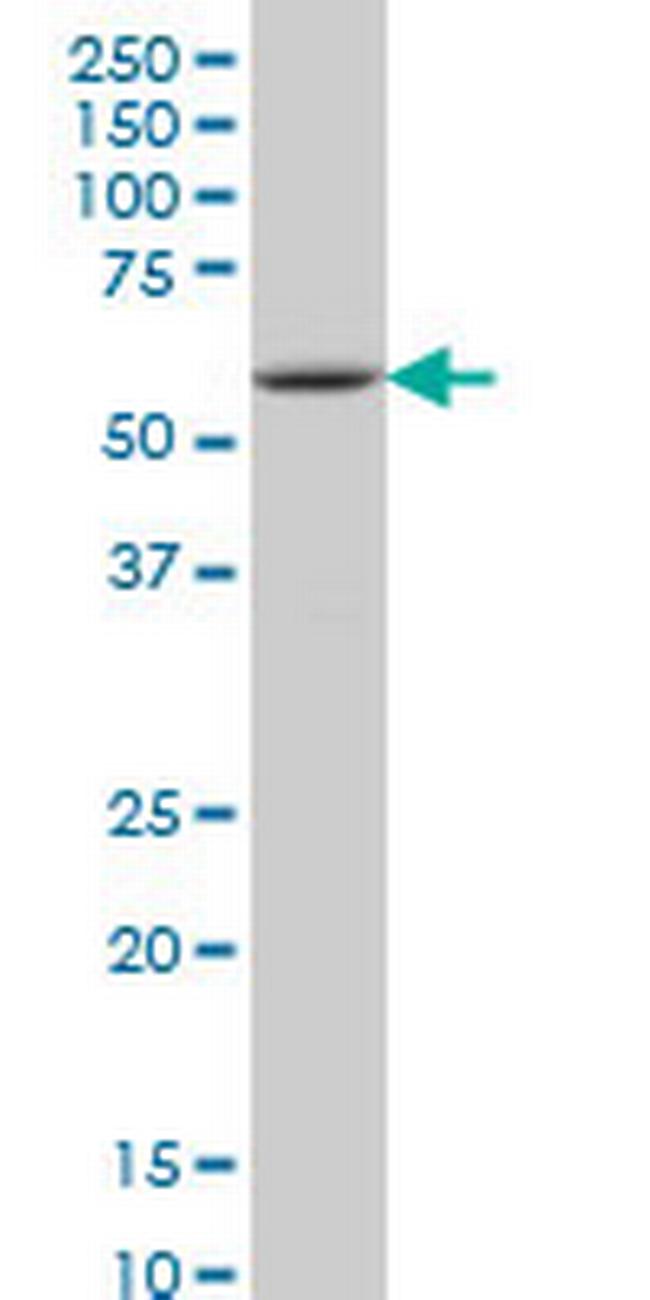 IRAK2 Antibody in Western Blot (WB)