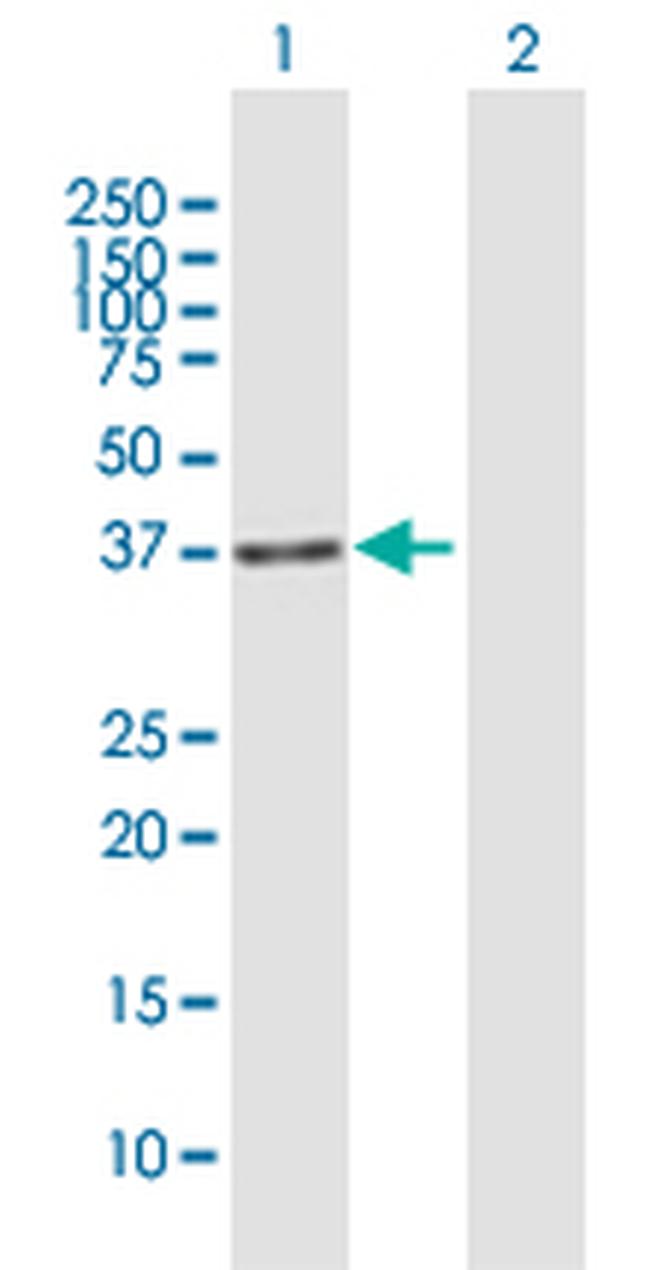 IREB2 Antibody in Western Blot (WB)