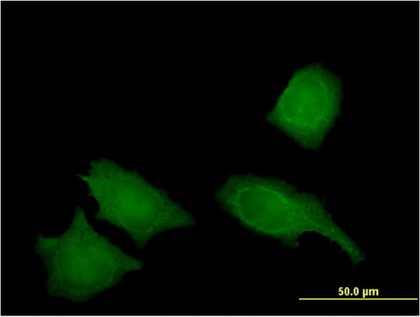 IREB2 Antibody in Immunocytochemistry (ICC/IF)