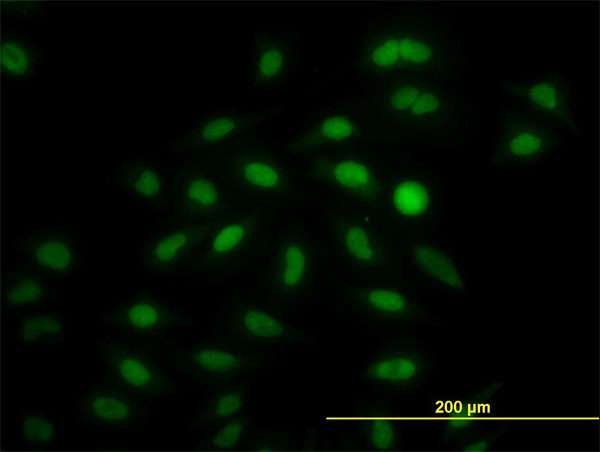 IRF2 Antibody in Immunocytochemistry (ICC/IF)
