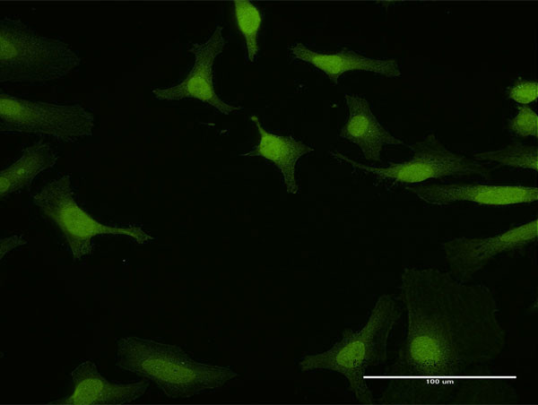 IRF5 Antibody in Immunocytochemistry (ICC/IF)