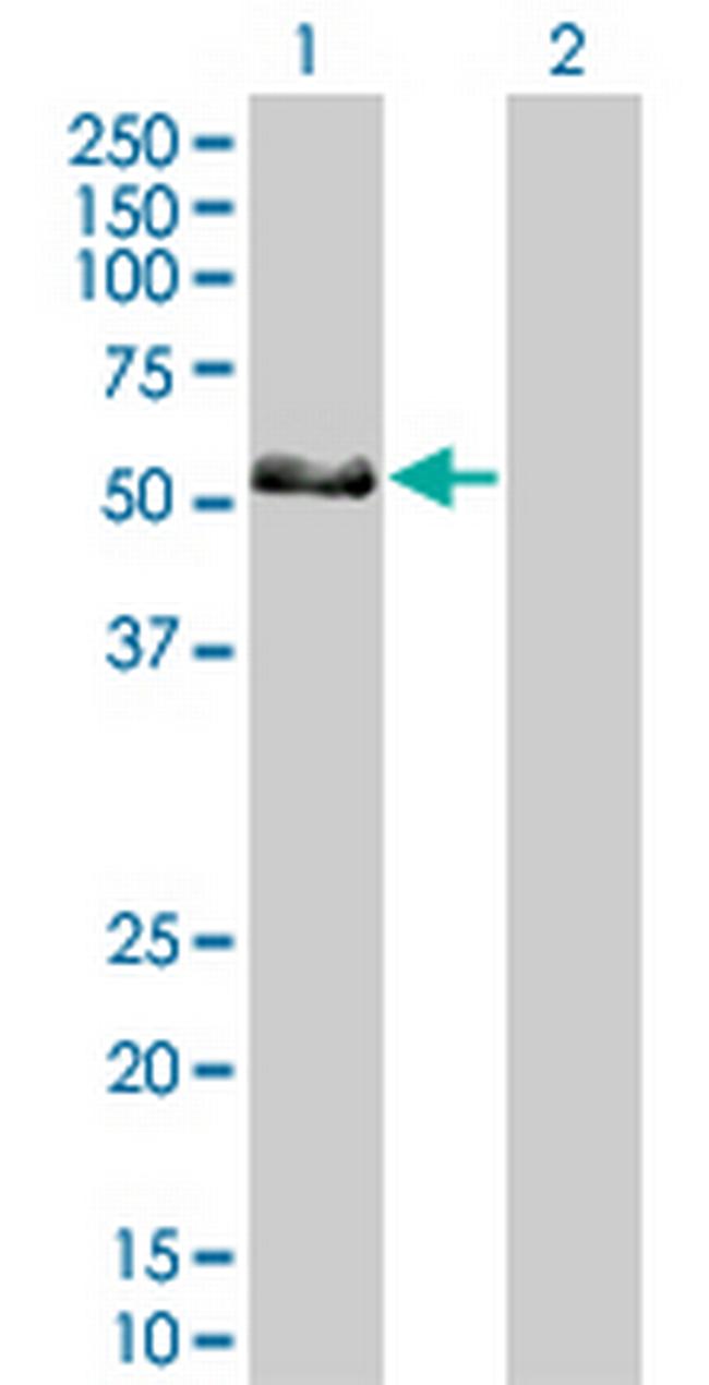 IRF6 Antibody in Western Blot (WB)