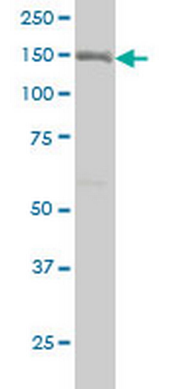 ITGA2 Antibody in Western Blot (WB)