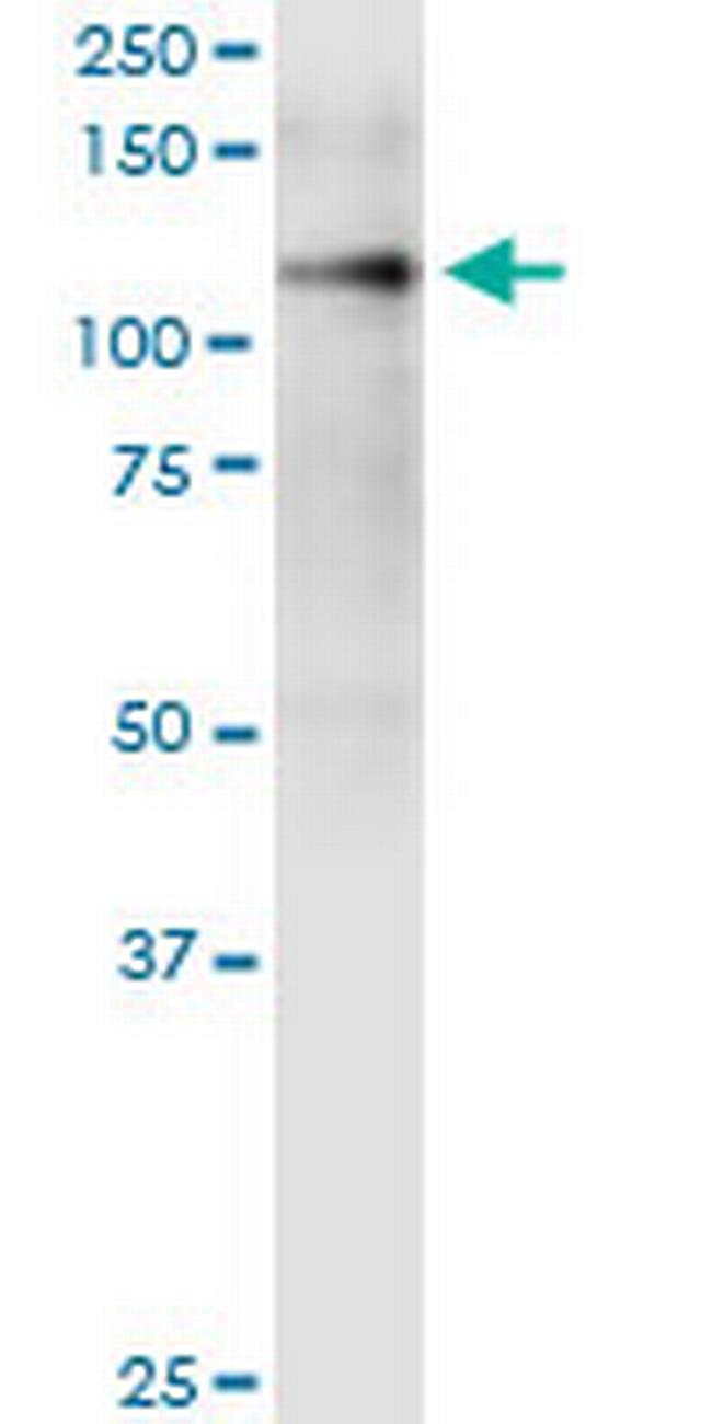 ITGA9 Antibody in Western Blot (WB)