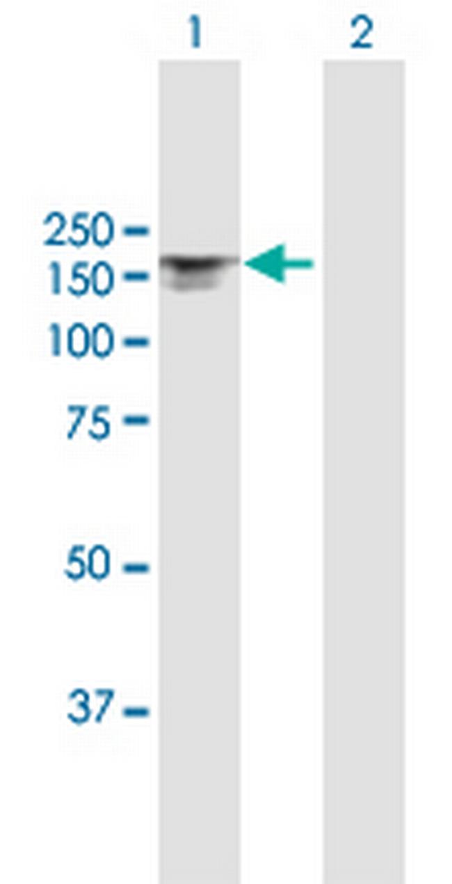 ITGAX Antibody in Western Blot (WB)