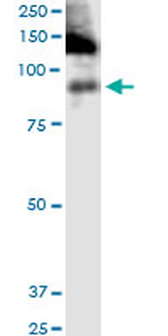 ITGB2 Antibody in Western Blot (WB)