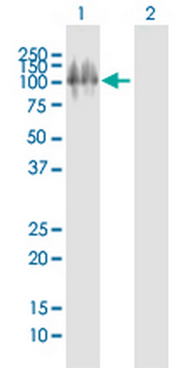 ITGB6 Antibody in Western Blot (WB)