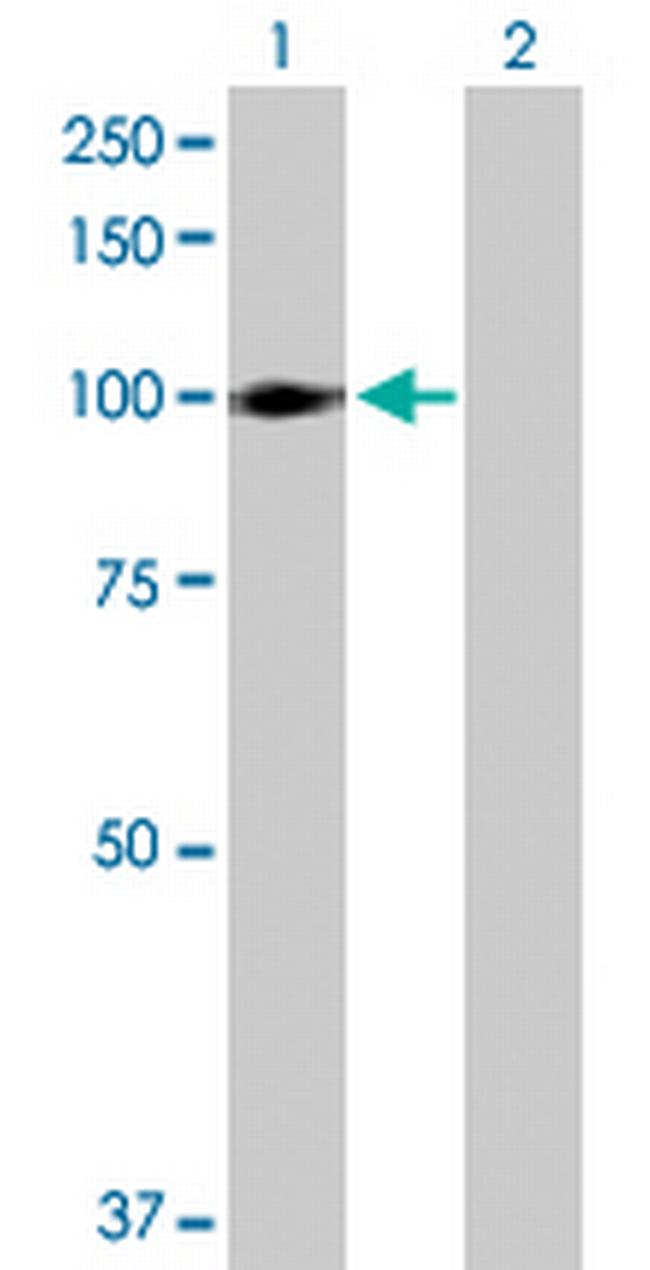 ITGB6 Antibody in Western Blot (WB)