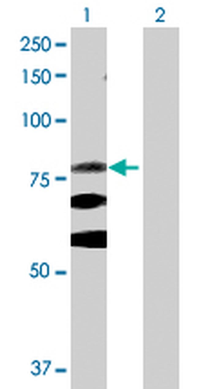 ITGB8 Antibody in Western Blot (WB)