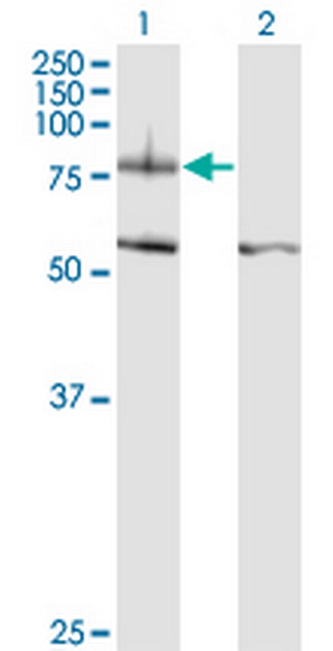ITGB8 Antibody in Western Blot (WB)