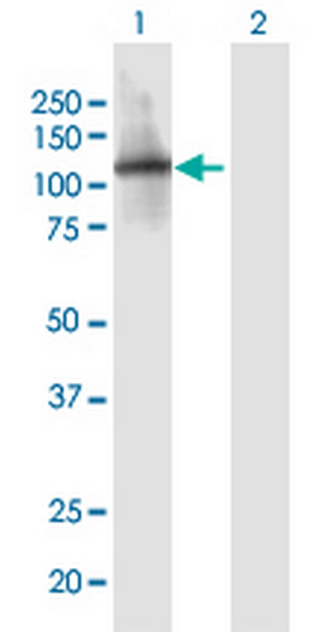 ITIH1 Antibody in Western Blot (WB)