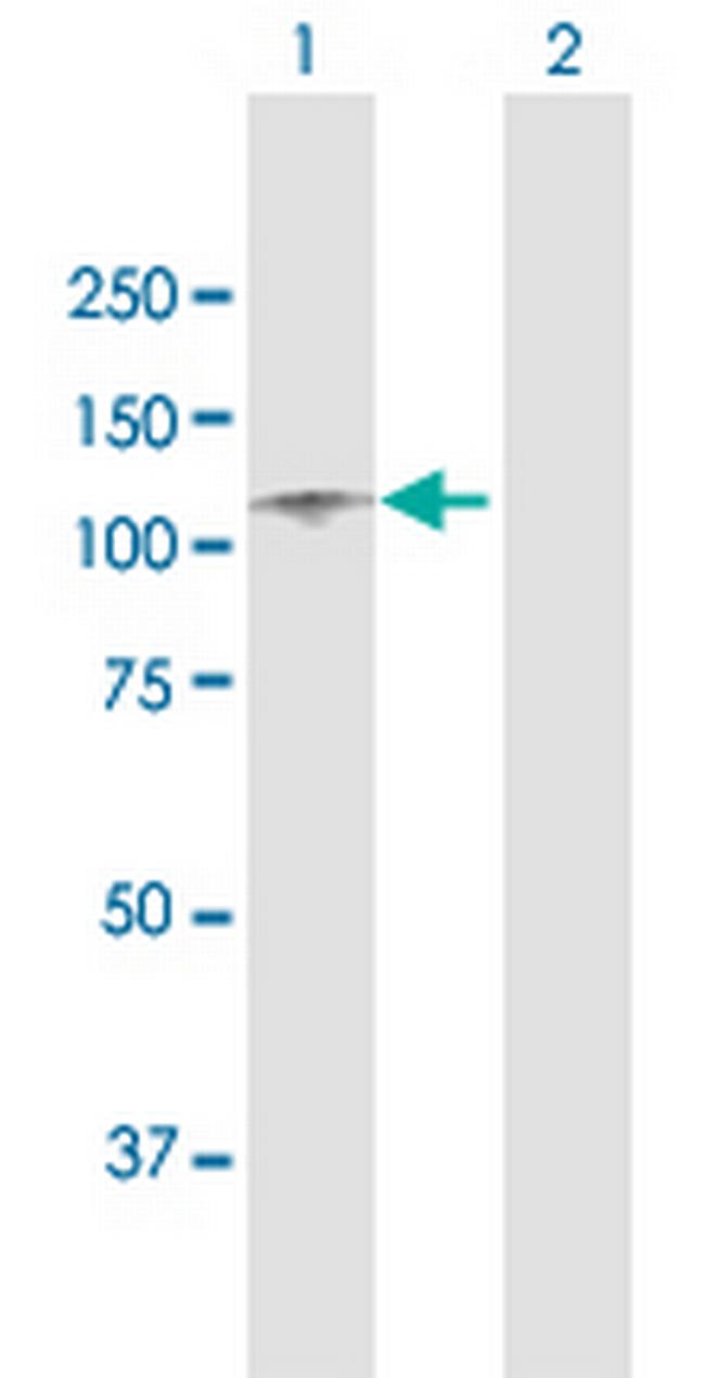 ITIH1 Antibody in Western Blot (WB)