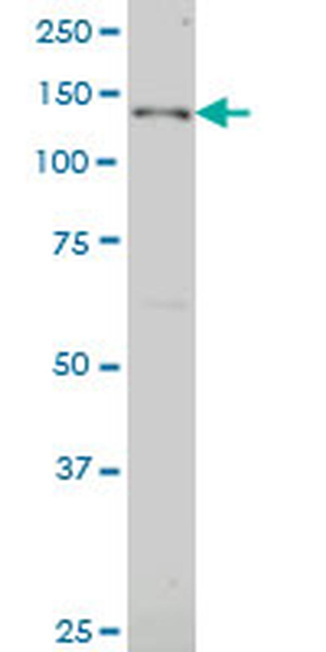 JAG2 Antibody in Western Blot (WB)