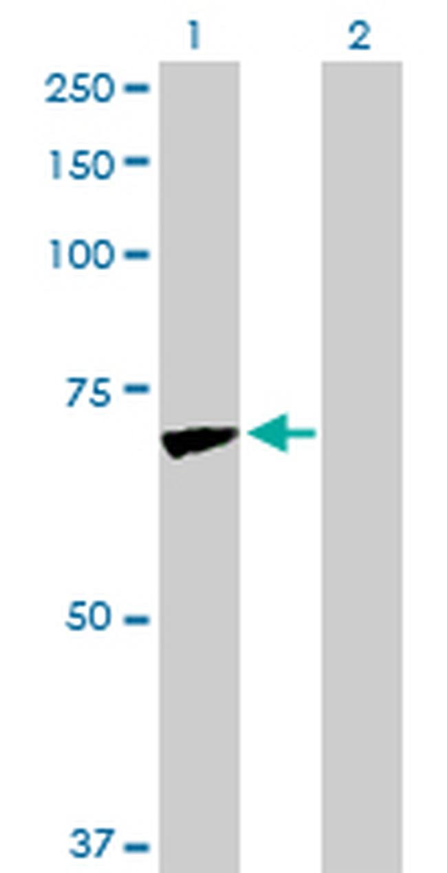 JUP Antibody in Western Blot (WB)