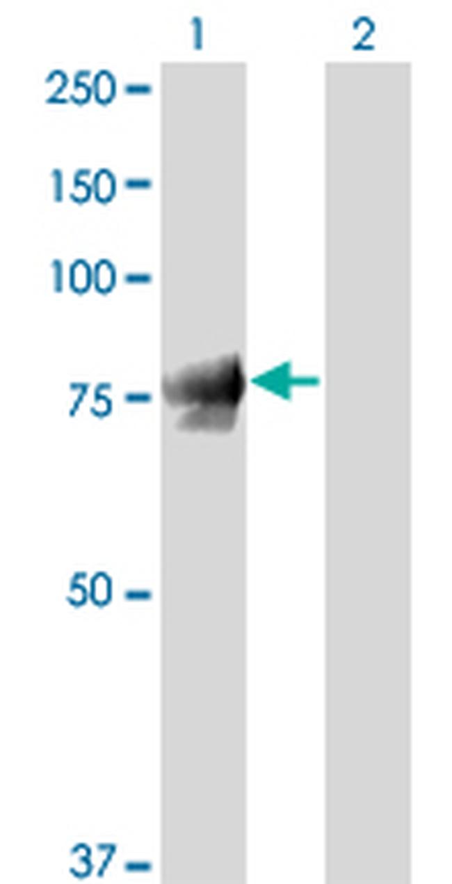 JUP Antibody in Western Blot (WB)