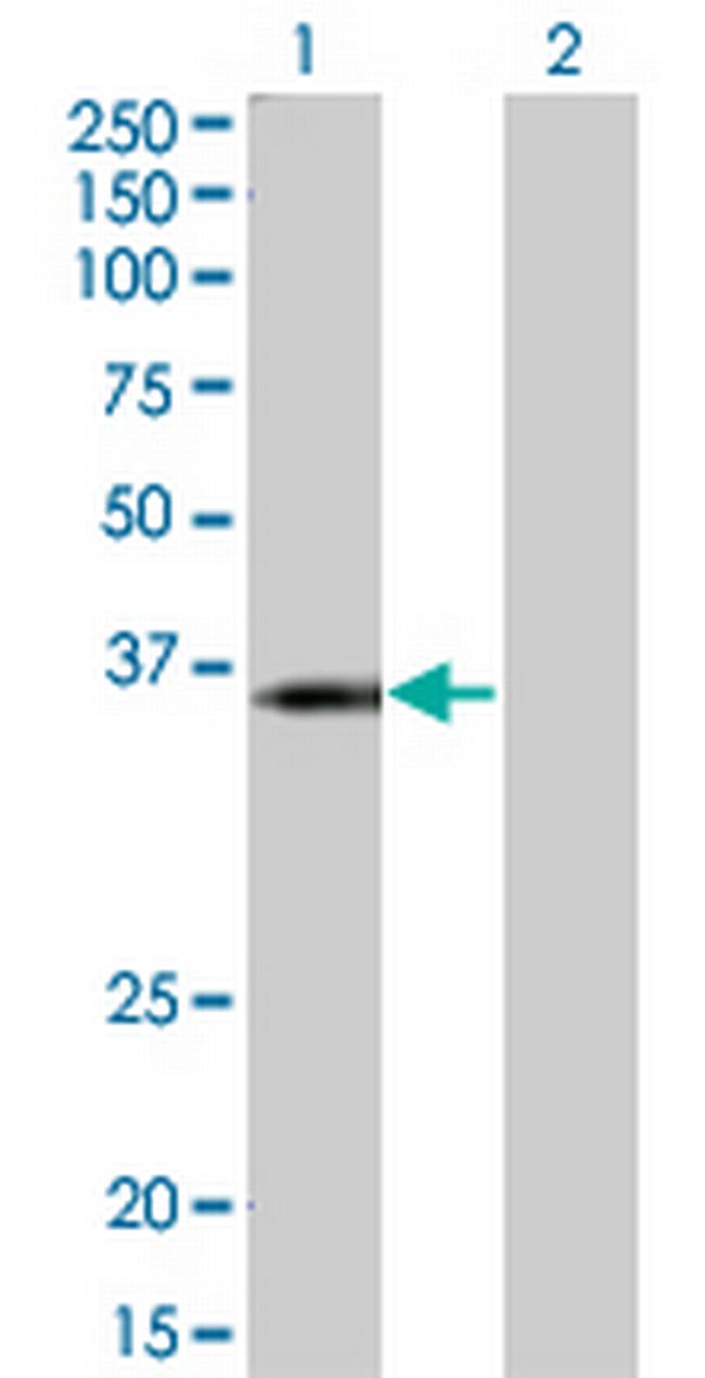 KCNJ15 Antibody in Western Blot (WB)