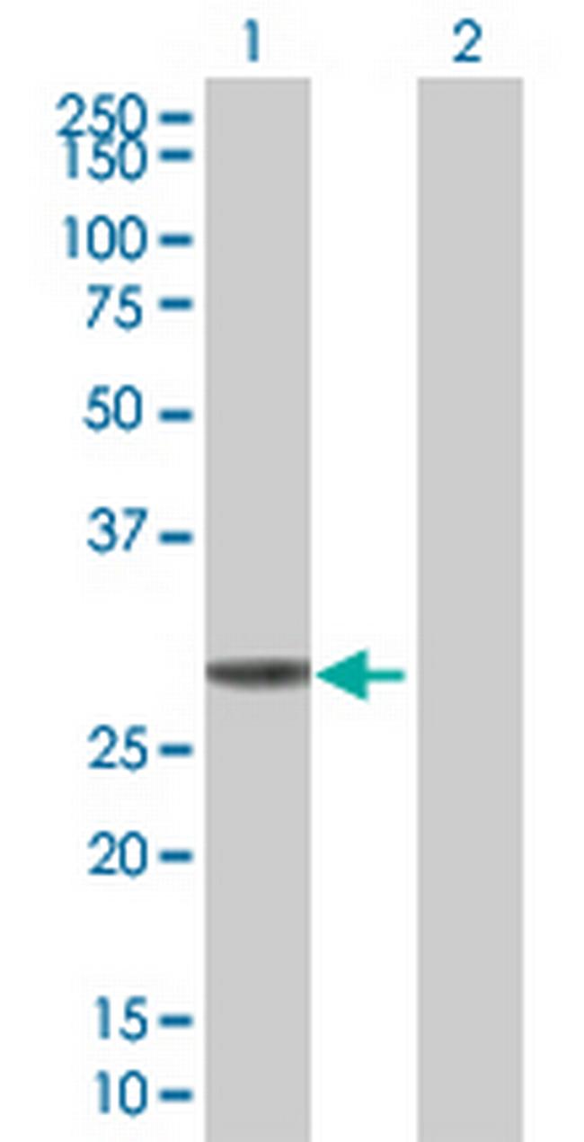 KHK Antibody in Western Blot (WB)