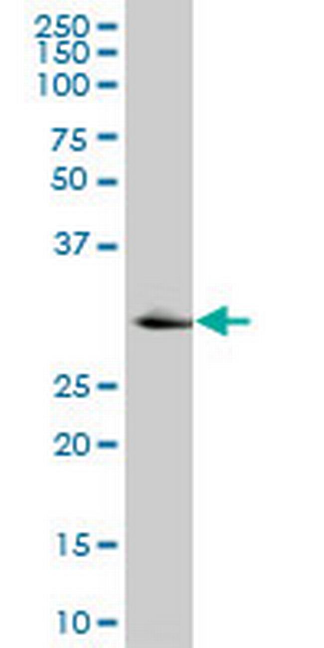 KHK Antibody in Western Blot (WB)