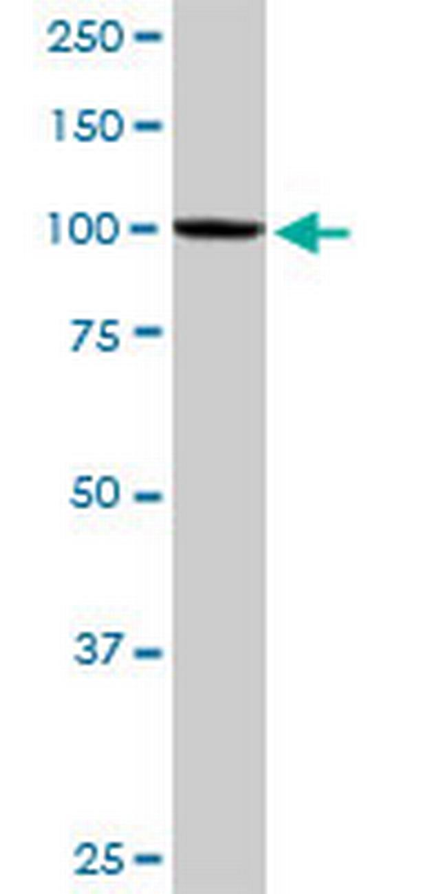 KIF3C Antibody in Western Blot (WB)