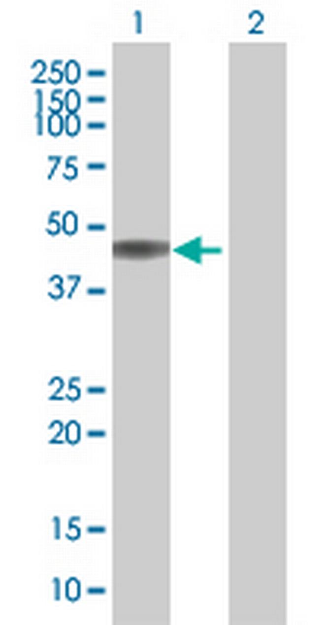 KIR2DL3 Antibody in Western Blot (WB)