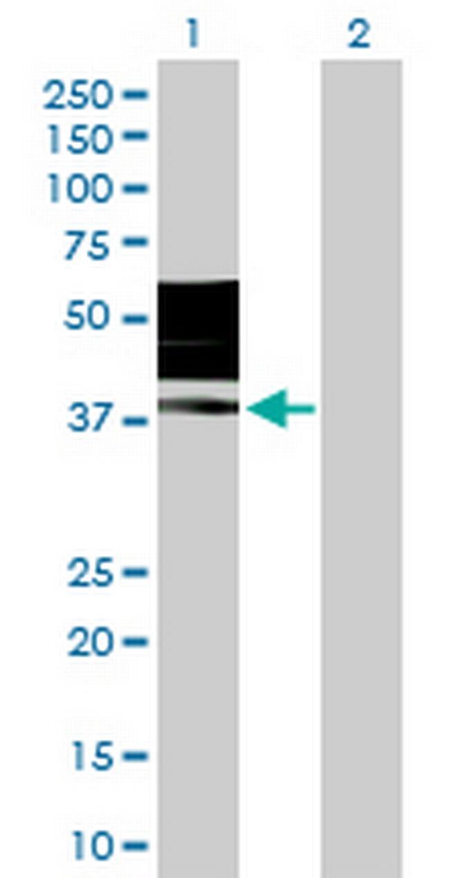 KIR2DL3 Antibody in Western Blot (WB)