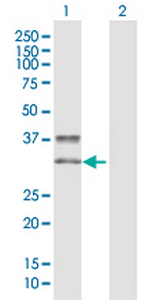KIR2DS3 Antibody in Western Blot (WB)