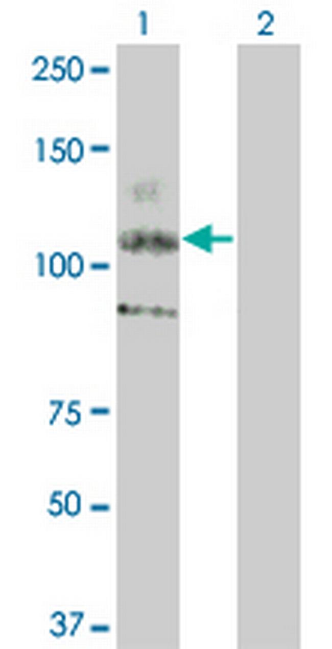 KIT Antibody in Western Blot (WB)