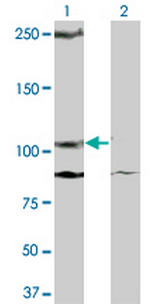 KIT Antibody in Western Blot (WB)