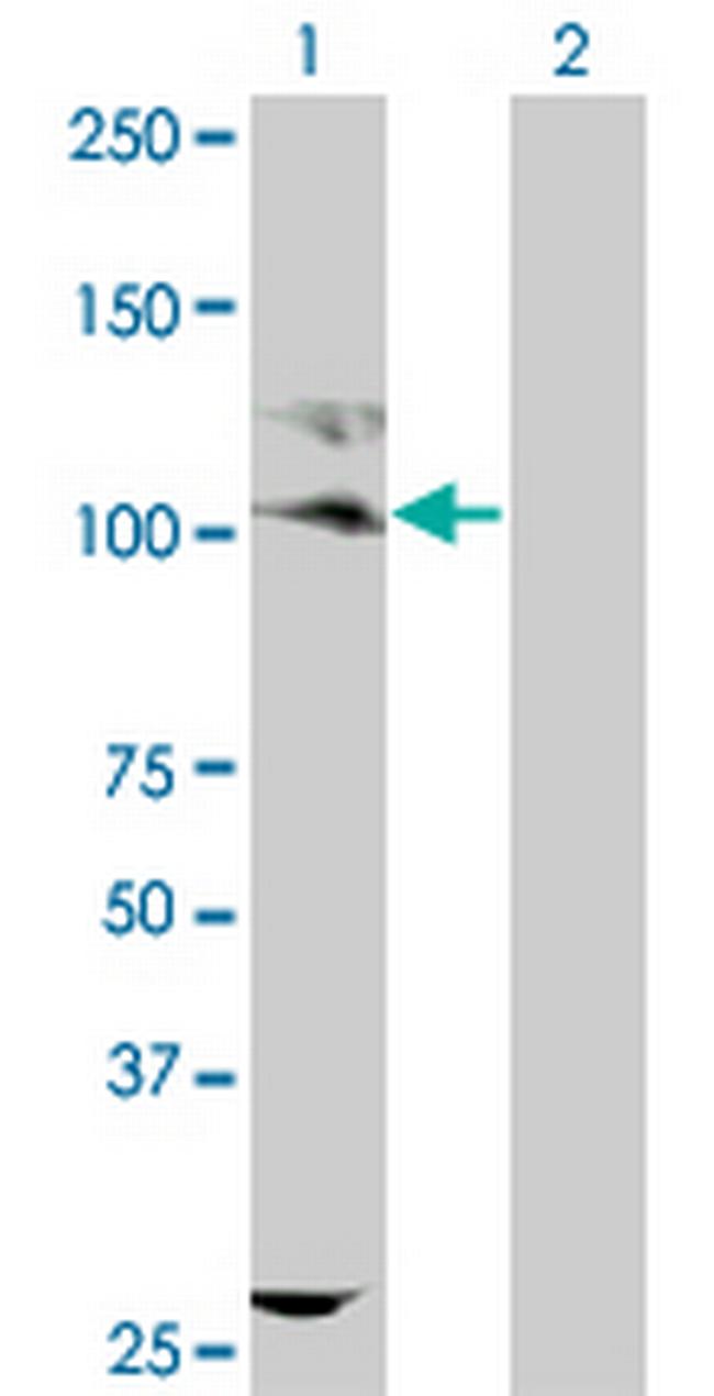 KIT Antibody in Western Blot (WB)