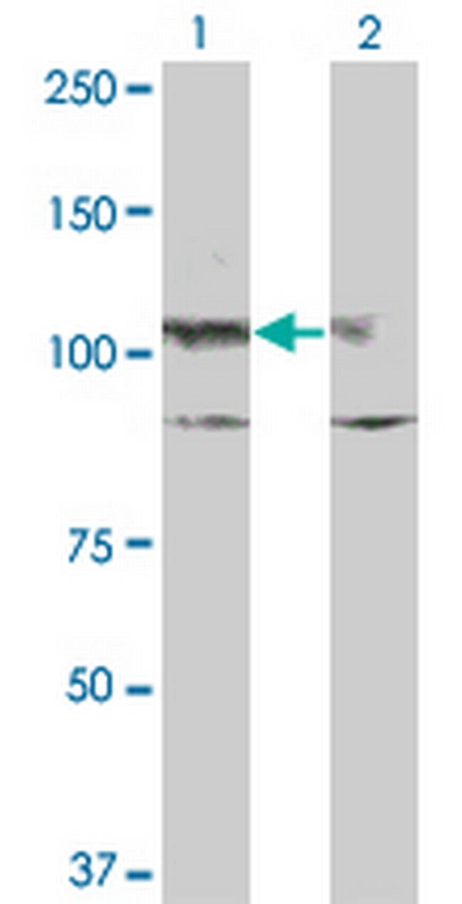KIT Antibody in Western Blot (WB)