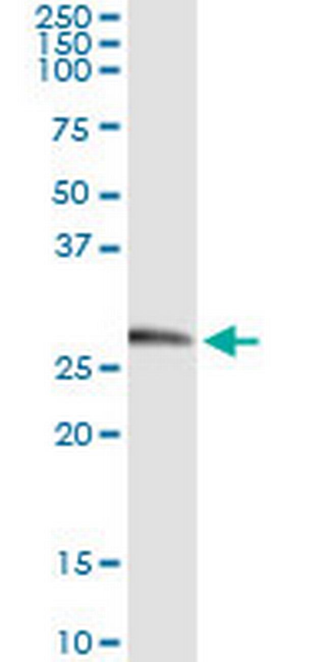 KLK2 Antibody in Immunoprecipitation (IP)