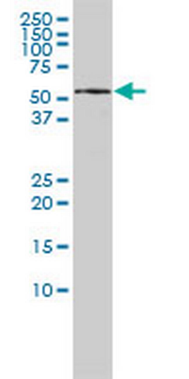 KPNA5 Antibody in Western Blot (WB)
