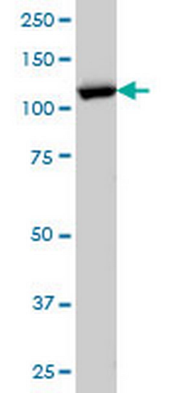 RANBP5 Antibody in Western Blot (WB)