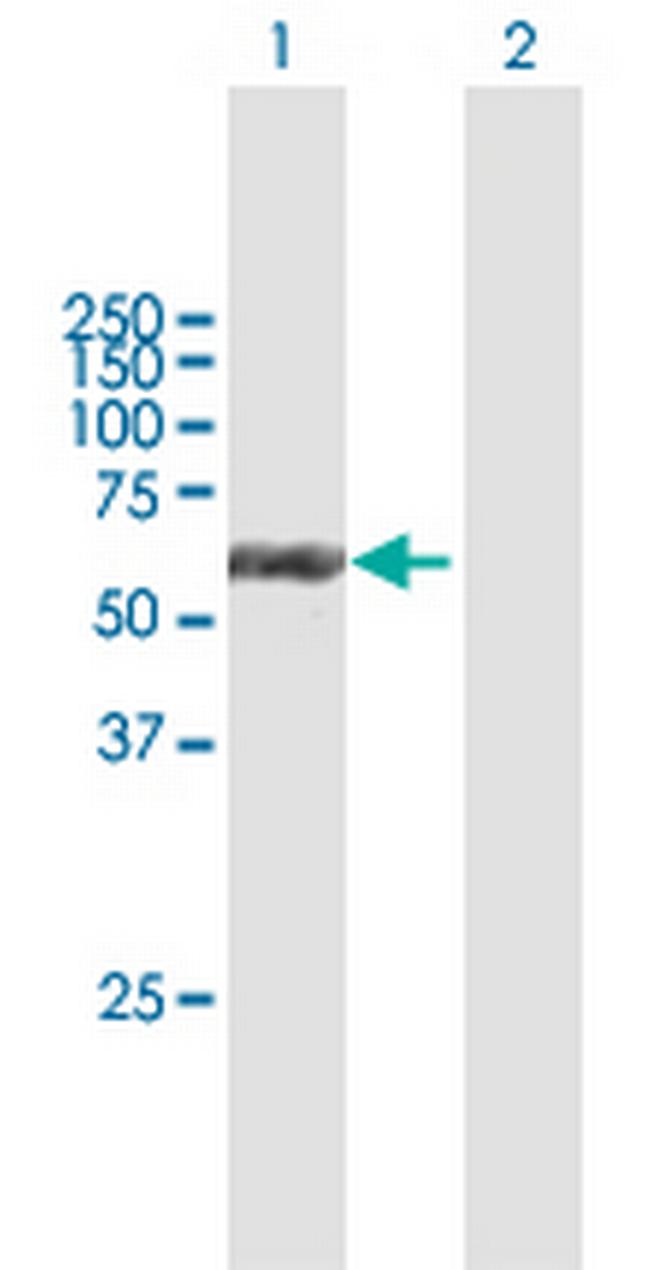 KRT6B Antibody in Western Blot (WB)