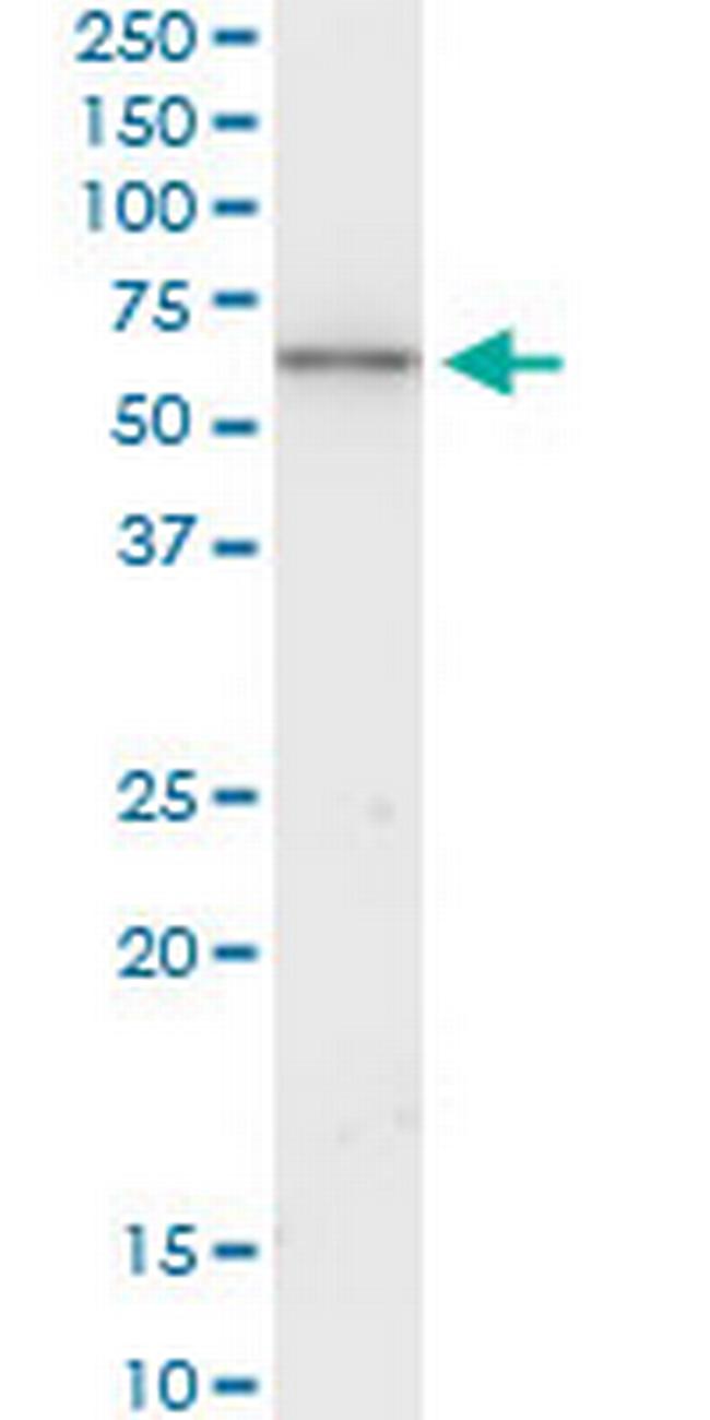 KRT6B Antibody in Western Blot (WB)