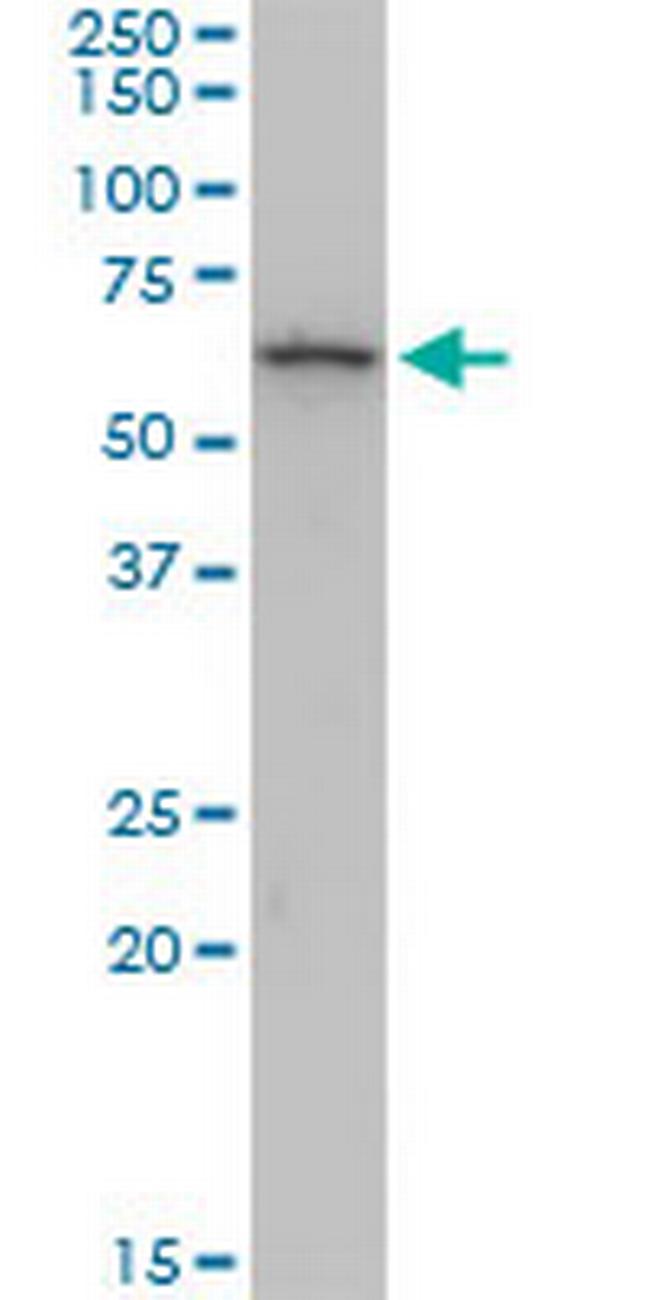 KRT6B Antibody in Western Blot (WB)