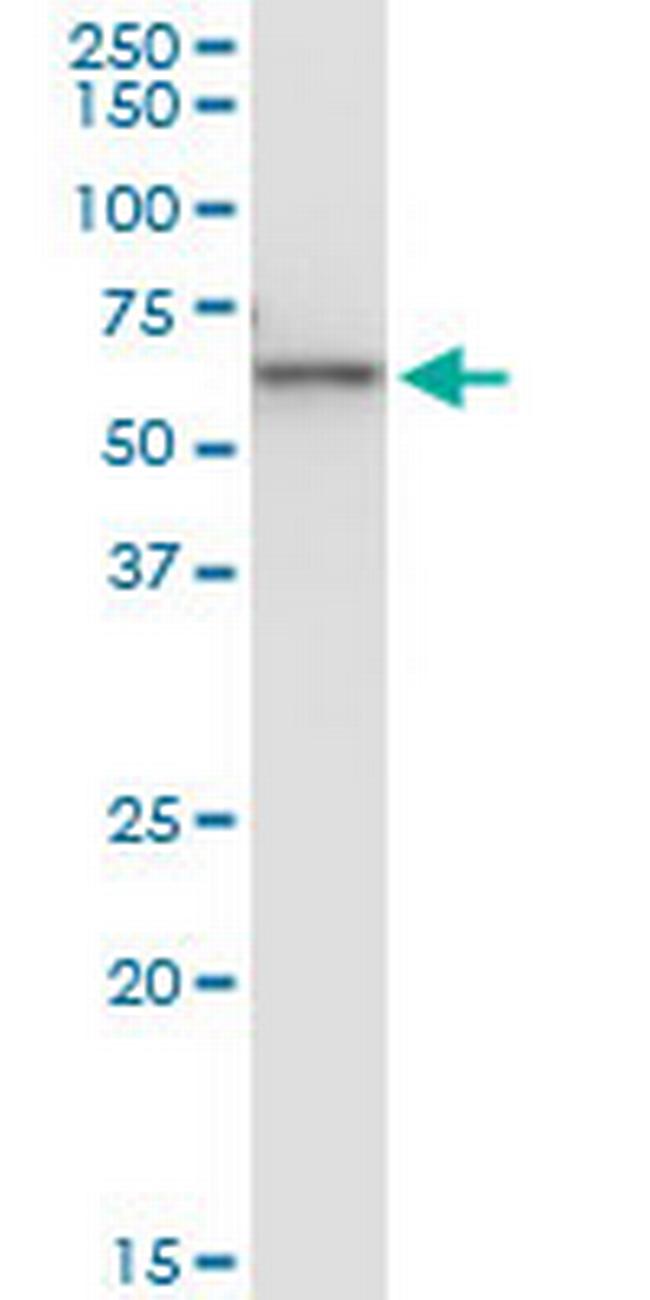 KRT6B Antibody in Western Blot (WB)
