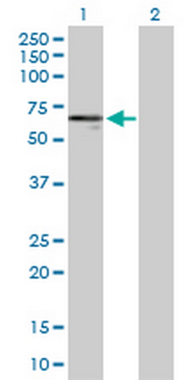 KRT14 Antibody in Western Blot (WB)