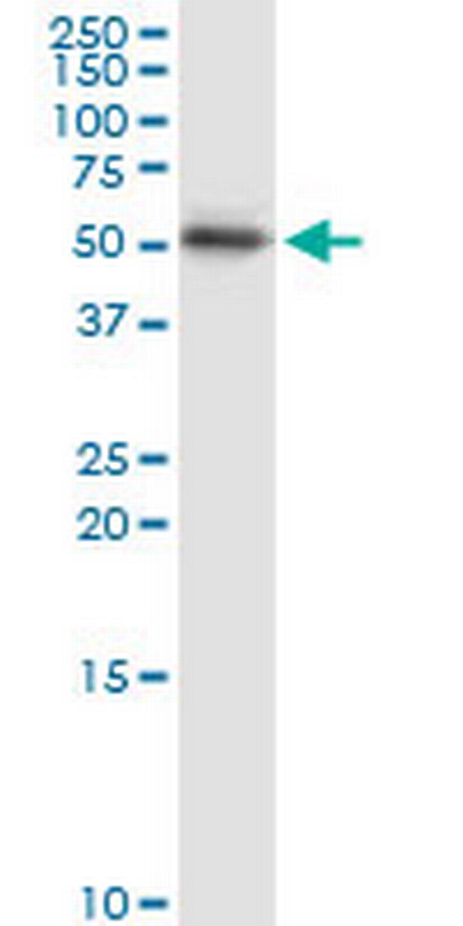KRT15 Antibody in Western Blot (WB)